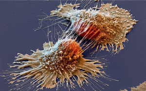 Nikolai Lackmann: Selbstheilung ist möglich – sogar bei Krebs!